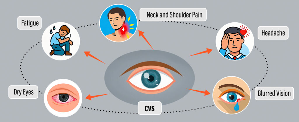 Common Symptoms of CVS