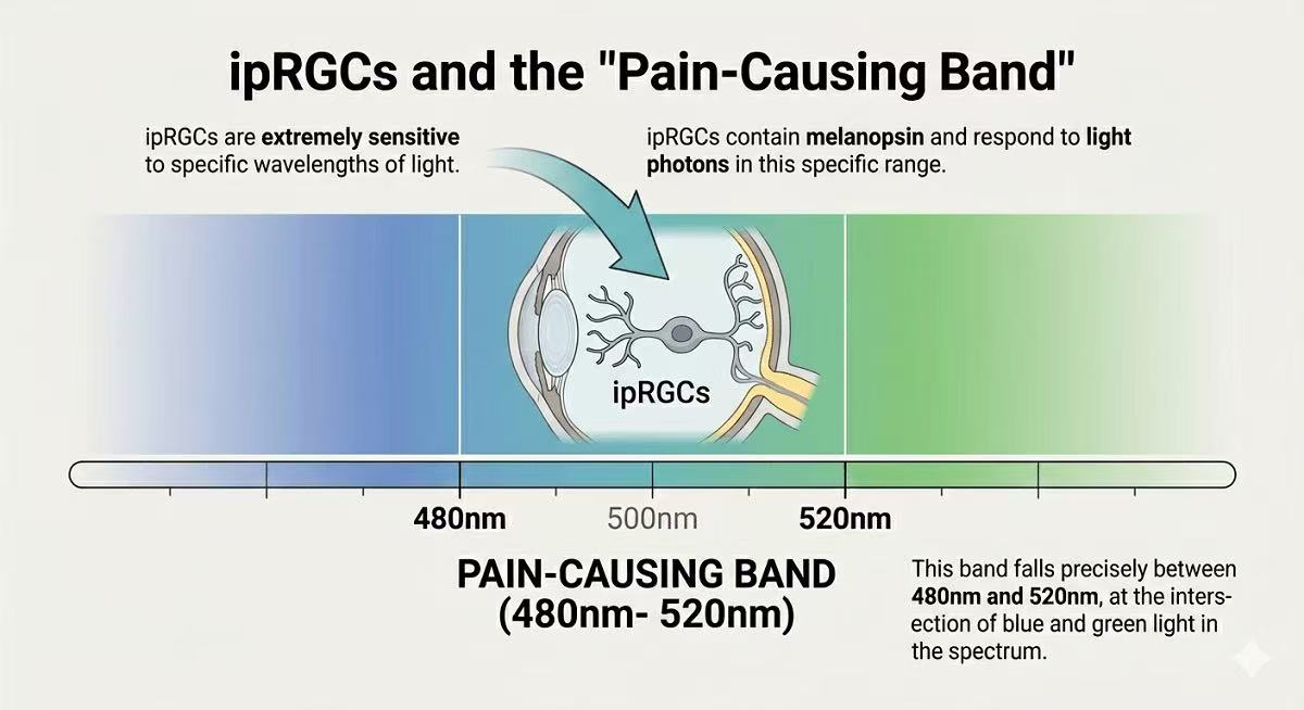 ipRGCs and Pain Causing Band