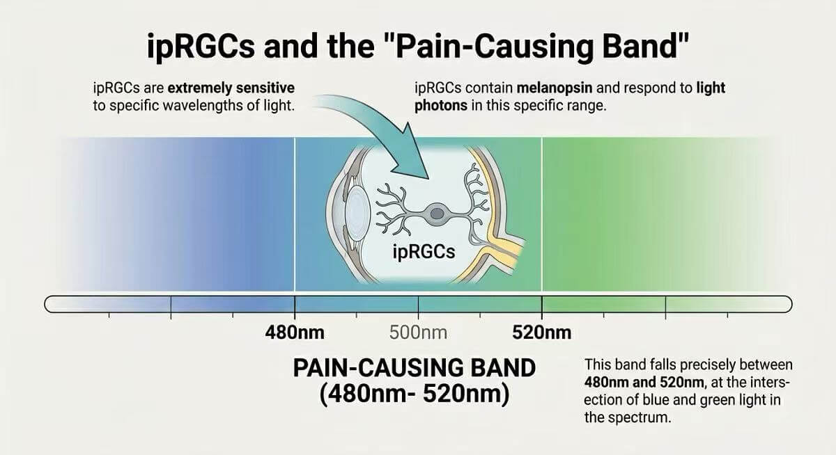 ipRGCs and Pain Causing Band